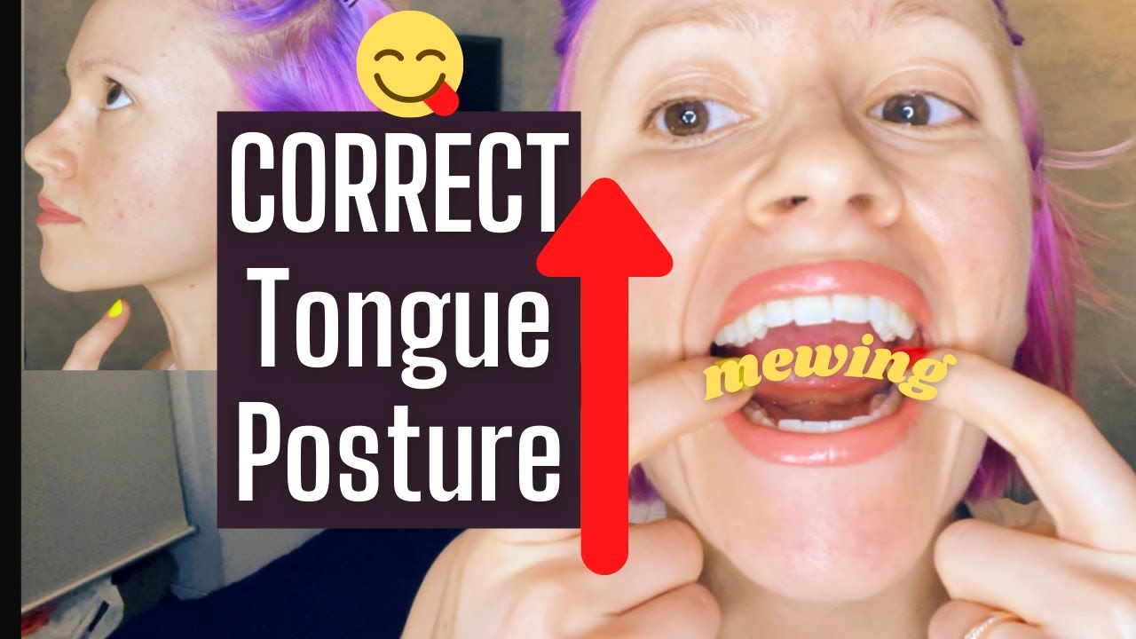 tongue posture how to do mewing Where should your tongue rest? proper tongue position explained