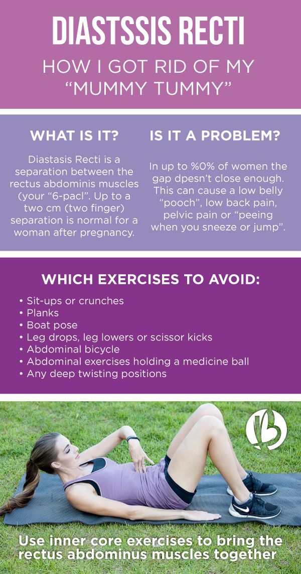 how to tell if you have diastasis recti Diastasis recti do abs after pregnancy treat plus normal during genevieve howland written updated august