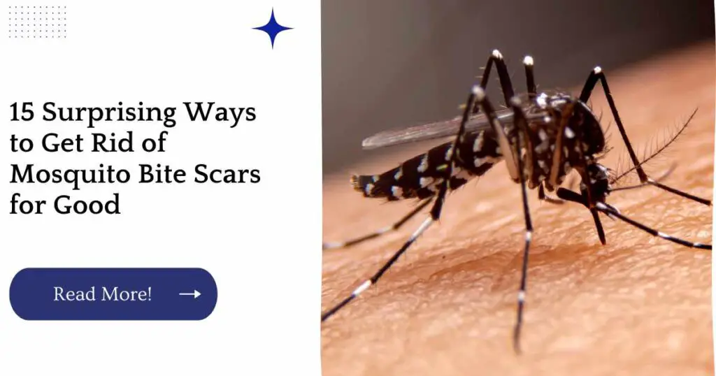 how to get rid of mosquito bite scars Mosquito bites bite mosquitos remedies remedios relieve caseros picaduras insect repelente treat remedy mosquitoes picadura heal healing holistic repelentes hormigas