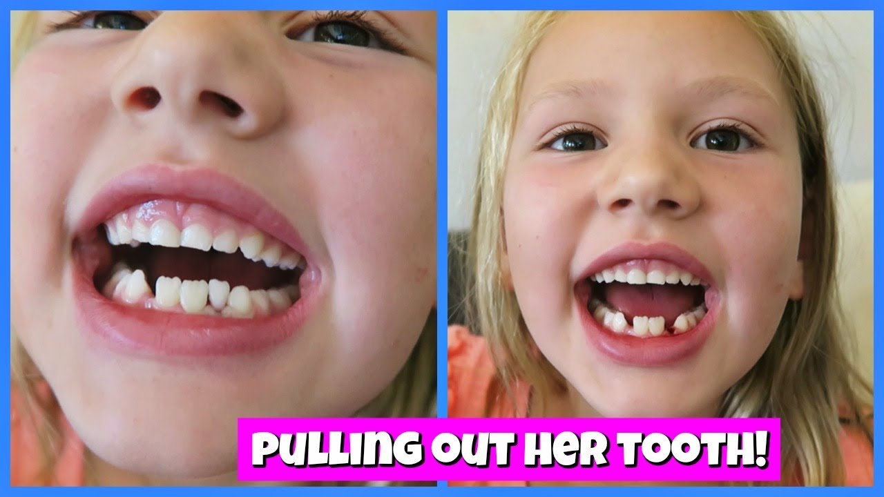 PULLING OUT HER LOOSE TOOTH! - YouTube