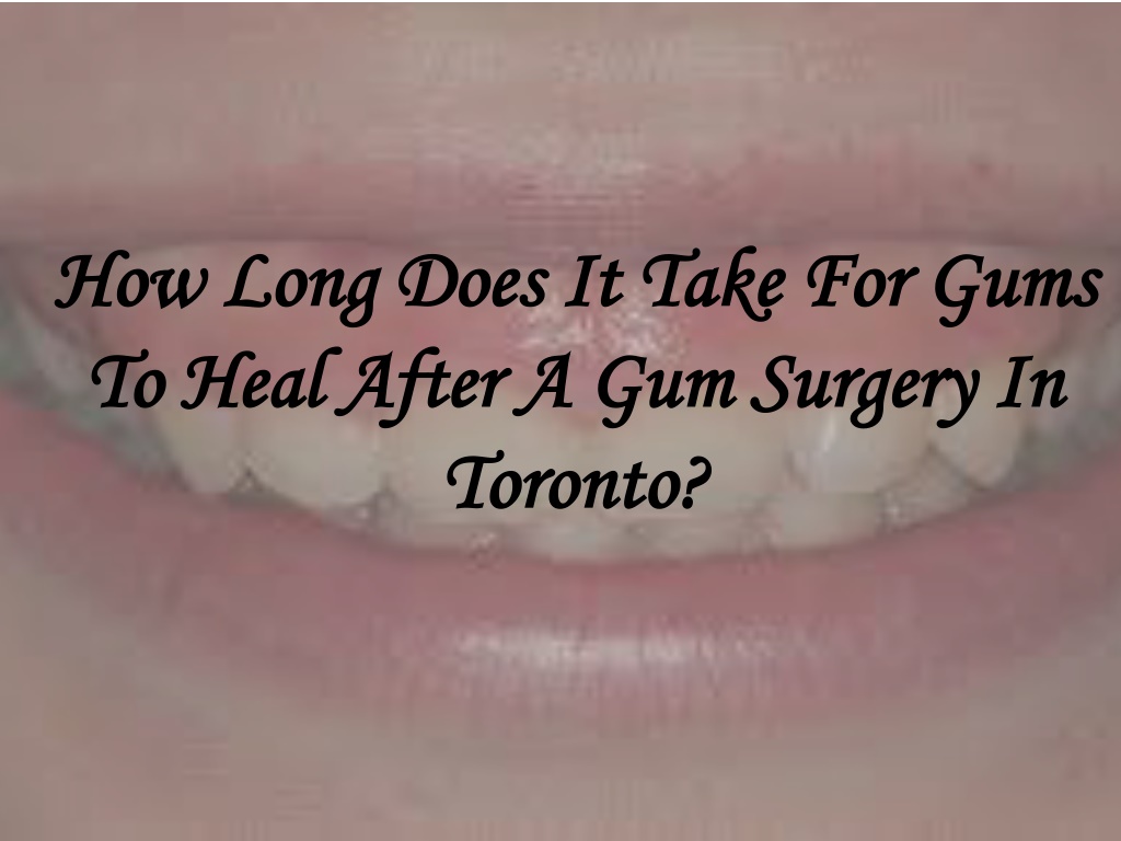 PPT - How Long Does It Take For Gums To Heal After A Gum Surgery In