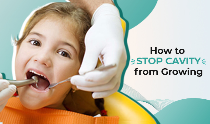 how to stop a cavity from growing Cavities naturally cavity rid reversed remedies