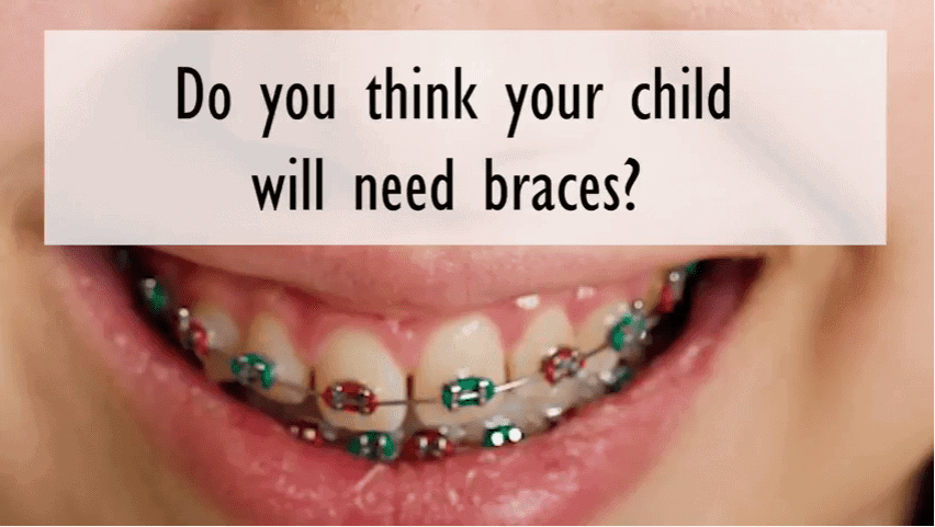 how to know if u need braces Do i need braces