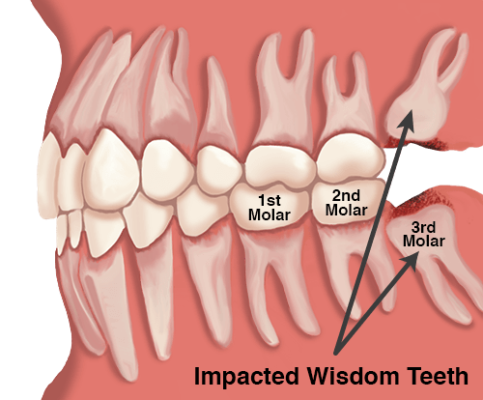 how long does it take for teeth to grow back Pin on best teeth infographics for dental health