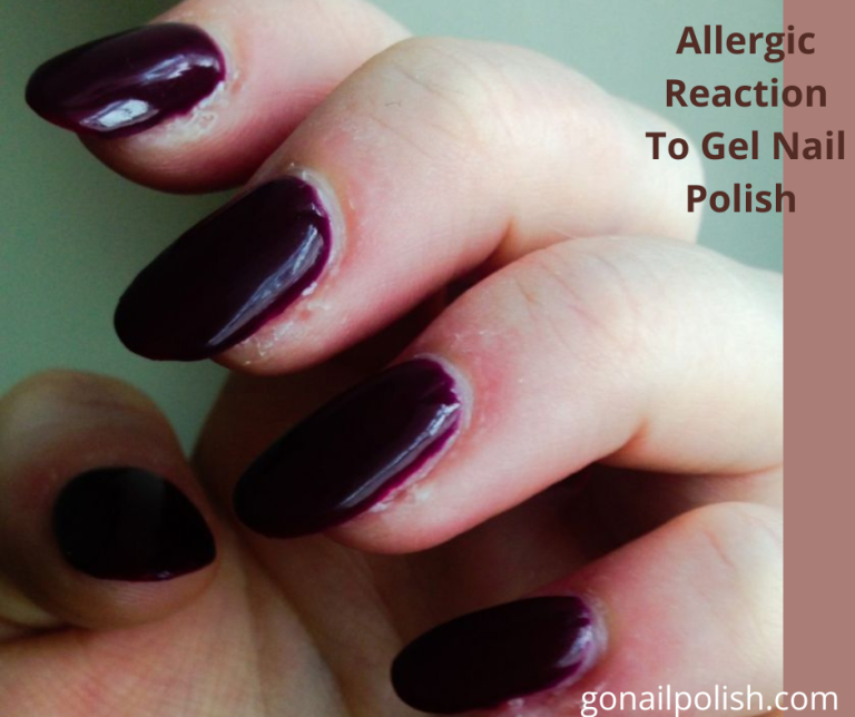 how to treat an allergic reaction to gel nail polish Brits tell of 'life-changing' allergies triggered by gel polish as