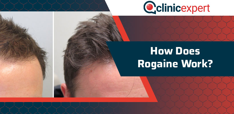 how long does rogaine take to work How does rogaine work?