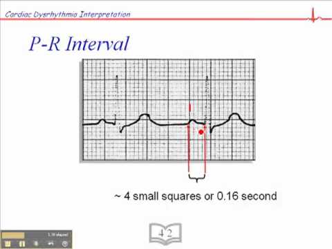 how to measure p-r interval Pr interval ecg ekg measurement normal vs long nursing nclex acls