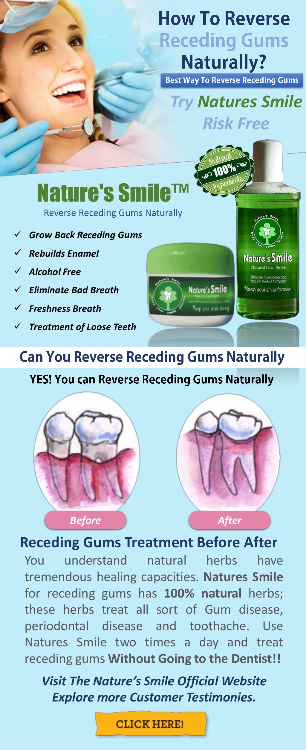 how to reverse receding gums at home Treating receding gums